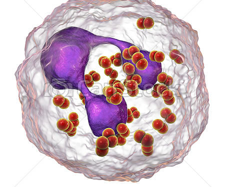 ¿Tienes una Infección de Transmisión Sexual o padece del VIH?